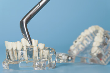 dental extraction forceps removing a tooth from a transparent anatomical jaw model against a blue background.