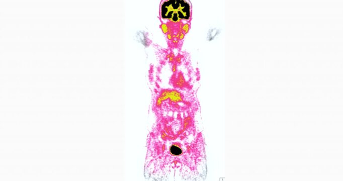 Colorful PET scan whole body imaging highlighting brain, spinal cord and internal organs for radiology, nuclear medicine and medical research.