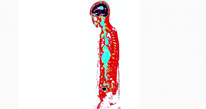 Colorful PET scan whole body imaging highlighting brain, spinal cord and internal organs for radiology, nuclear medicine and medical research.