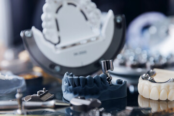 Exhibition examples of dental prostheses, titanium crowns and platforms for pins made on mini CNC...