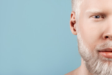 Fototapeta premium Albinism. Portrait of albino bearded man with white hair and pale skin looking at camera over grey background with free space. Unusual appearance and skin abnormality