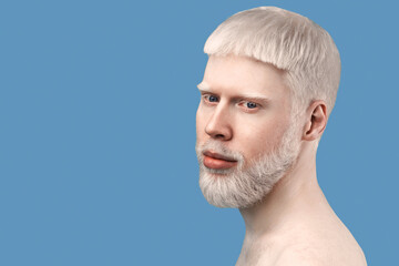 Carefree young albino guy with pale skin and white hair, posing to camera without shirt against...