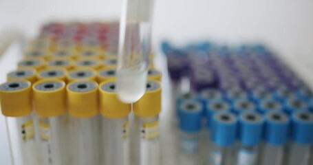 A precise moment in a laboratory showing a pipette dispensing liquid into one of many test tubes, focused amidst a blur of multicolored tube tops. Pipette Dispensing Liquid into Test Tubes in a Lab - Powered by Adobe