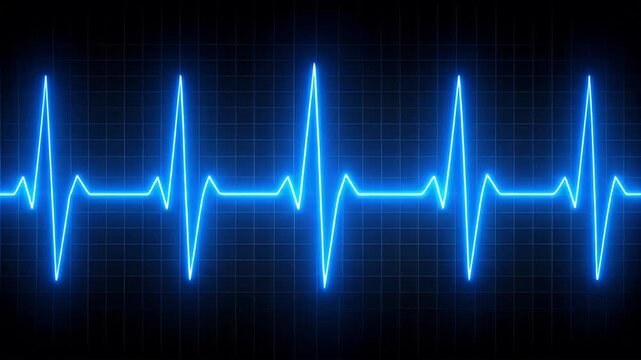 EKG/ECG wave, blue, glowing, jagged lines on a dark background with a blue grid