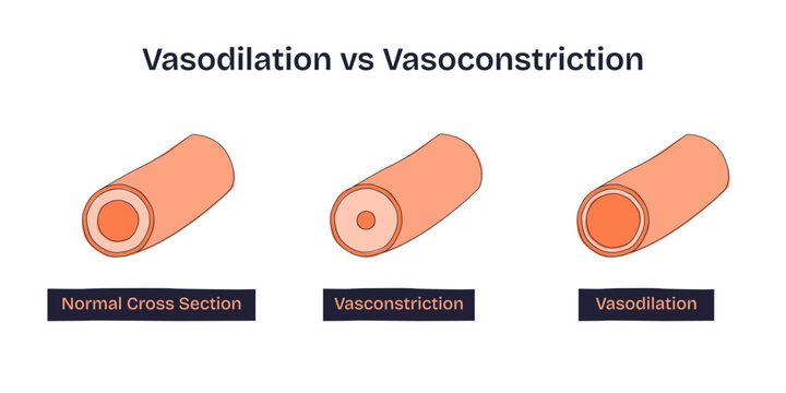 Vasodilation vs Vasoconstriction shows blood vessel changes, highlighting normal, constricted, and dilated arteries, transparent background. Doodle style diagram