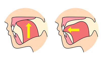 正しいミューイングの方法　適正な舌の位置と誤った舌の位置 © koti