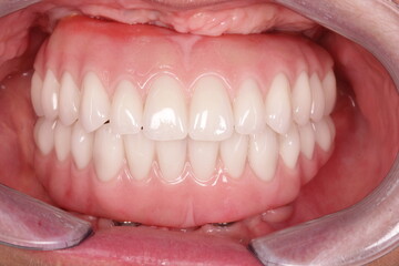 close up of teeth