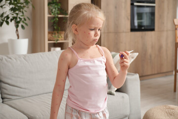 Sad little girl ill with chickenpox holding thermometer at home