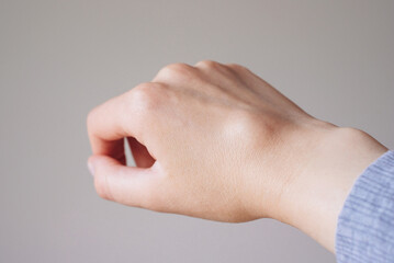 Female right back hand with ganglion cyst on the dorsum,  fluid-filled bump associated with a joint or tendon sheath, close-up view, selected focus.