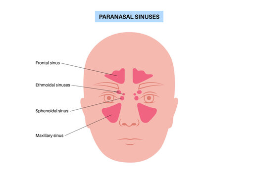 Paranasal sinus poster