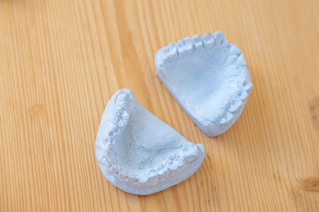 Two light dental plaster casts, Orthodontic models upper and lower jaw, Preparation for braces or...