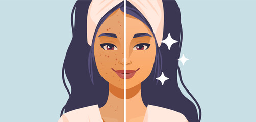 Woman skincare before and after acne treatment facial split clean glowing skin beauty transformation headband flat color background