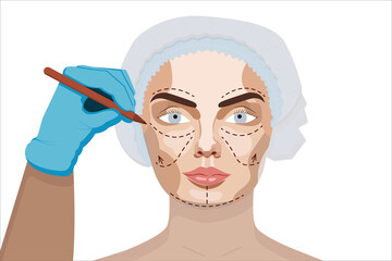 An illustration of a cosmetic surgery procedure showing a gloved hand marking a woman's face with a marker, wearing a surgical cap, on a white background.