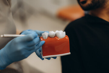 Dentist showing teeth model to patient explaining treatment in clinic