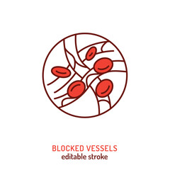 Vector medical icon of blocked vessels showing blood clot and circulation disorder.