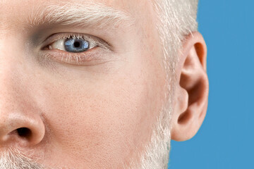 Albinism concept. Portrait of young bearded albino man with white hair, pale skin and blue eyes...