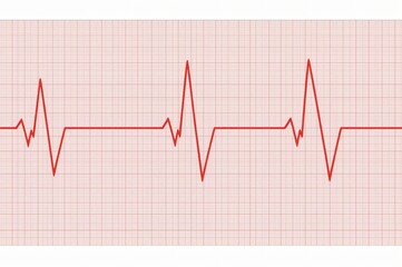 Naklejka premium Irregular heartbeat EKG graph, medical illustration