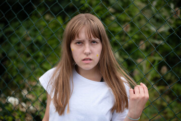 A teenage girl is sad because she has acne on her face and headache, she walks outside to relieve...