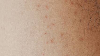 The close-up view captures the detailed texture of skin on a knee. Small bumps and fine hairs...