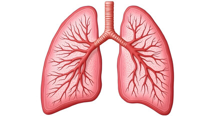 Anatomy & Physiology A cross-section of lung tissue in pneumonia, isolated on white, showing alveolar exudate and inflammation for pathology and pulmonology education(2)