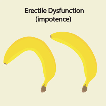 Vector illustration of erectile dysfunction showing difficulty achieving erection, low libido, and related conditions like Peyronie&rsquo;s disease and hormonal disorders banana 