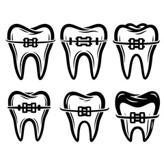 Collection of six stylized teeth with dental braces and wires forming a silhouette isolated on transparent background