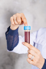 Naklejka premium Close-up of a doctor gloves working in a testing laboratory