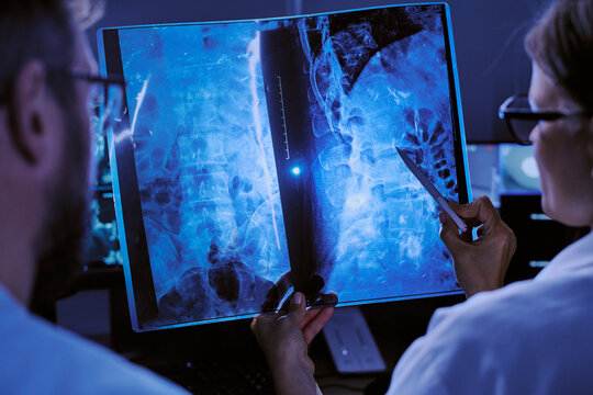 Caucasian male doctor and Caucasian female doctor examining spinal X-ray image together, discussing diagnosis and pointing at specific area on radiograph in medical office