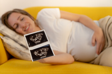 A Joyful Expectant Mother Sitting on a Couch, Holding Her Ultrasound Picture with Anticipation....