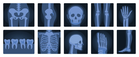 Xrays films of human body set, radiography and anatomy vector illustration. Cartoon isolated medical roentgen scans with silhouettes of bones of skeleton, joint and articulation of legs and hands