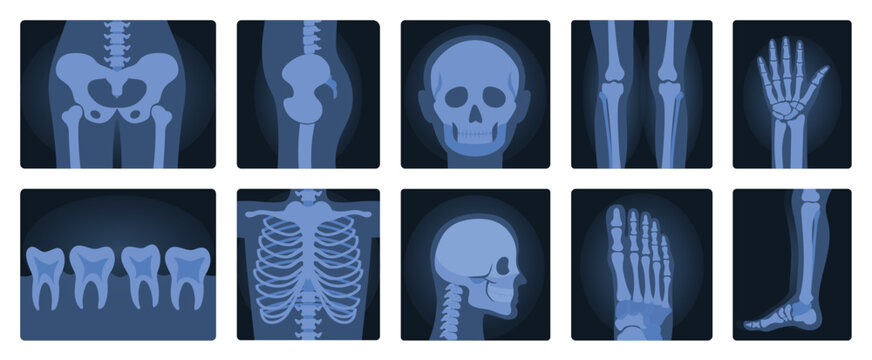 Xrays films of human body set, radiography and anatomy vector illustration. Cartoon isolated medical roentgen scans with silhouettes of bones of skeleton, joint and articulation of legs and hands