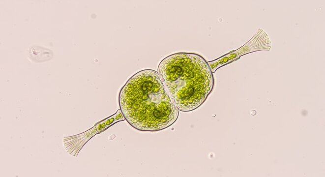 Light Microscope Image of a Desmid Algae Showing Its Distinctive Bilobed Form

