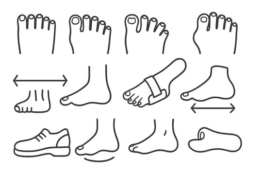Toe Alignment Doodles. Hand-drawn doodle illustration toe alignment big toe, curved toe, overlapping toes, hammer toe icon, bunion