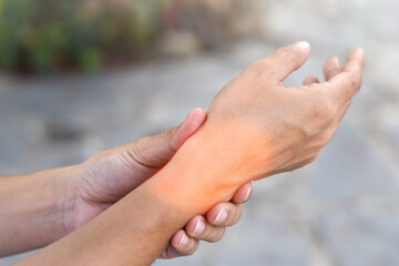 Wrist affected by a medical condition, showing visible signs of inflammation, swelling, or...
