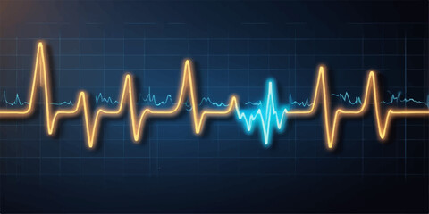 A medical ecg cardiogram graph shows a pulse rate heartbeat on a green line monitor