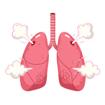 Lung Illustration: Damaged Respiratory System