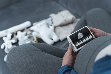 A pregnant woman sitting on a sofa holding an ultrasound image of her unborn baby. Baby clothes and...
