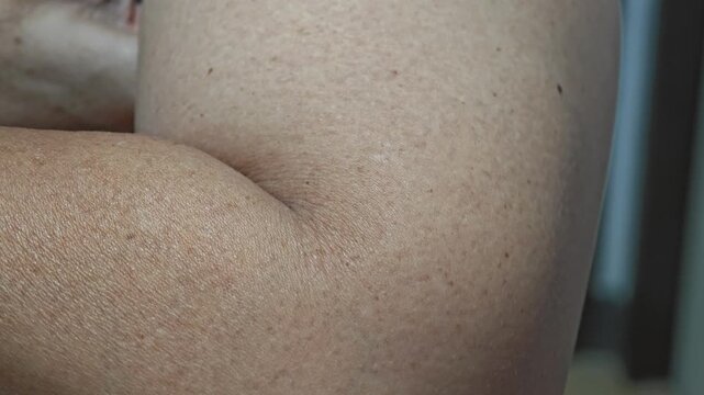 Arm muscle twitching. Muscle spasms.