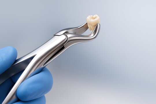 Tooth extraction with dental forceps closeup, dentist holding removed molar, oral surgery concept, dental care procedure, dentistry treatment illustration, extracted tooth in steel pliers
