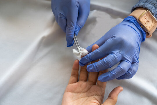 Close-up of healthcare worker wearing gloves applying cotton on patient’s finger after capillary blood test procedure. - Powered by Adobe