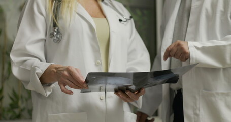 Doctors reviewing and discussing X-ray results during clinical diagnosis in hospital setting with focused expressions and collaborative teamwork