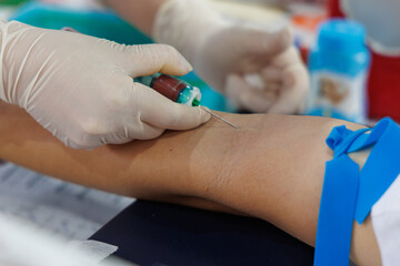 Get vaccinated against influenza. A Medical Professional Administering a Vaccine Shot to a Patient's Arm