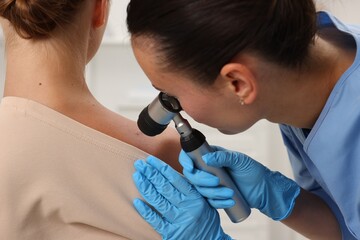 Doctor examining young woman's mole with dermatoscope in hospital, closeup