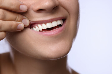 Woman showing her teeth and gums on light background, closeup
