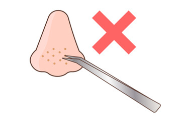 ピンセットで角栓を出すイラスト　NG 間違ったケア