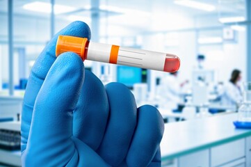 Doctor holding human test blood sample