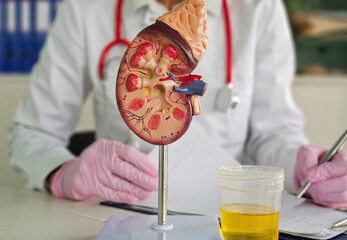 Medical professional examines kidney model while reviewing urine sample