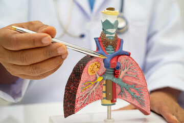 Pneumonia, lung cancer, Asian doctor holding human anatomy model for study diagnosis and treatment...