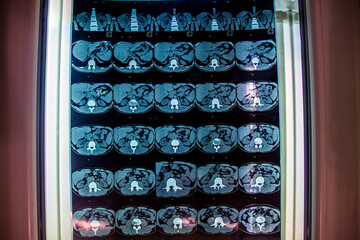 Internal organs on a CT scan