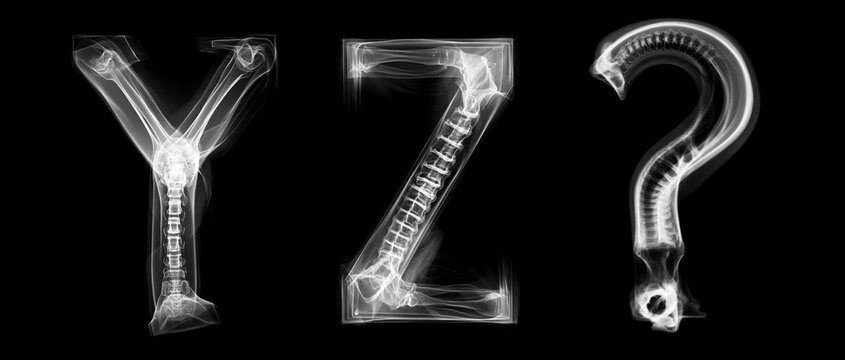 Medical X-ray style typography showing letters Y Z created from bones and skeleton structures